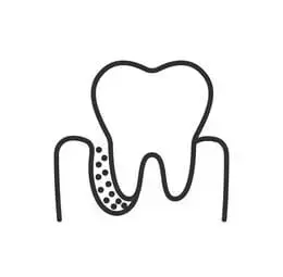Close-up of gum graft surgery in progress